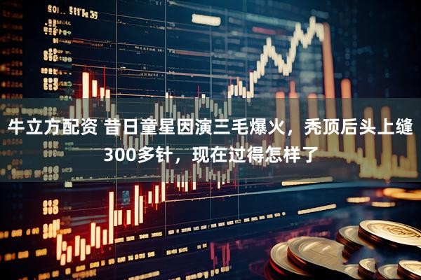 牛立方配资 昔日童星因演三毛爆火，秃顶后头上缝300多针，现在过得怎样了